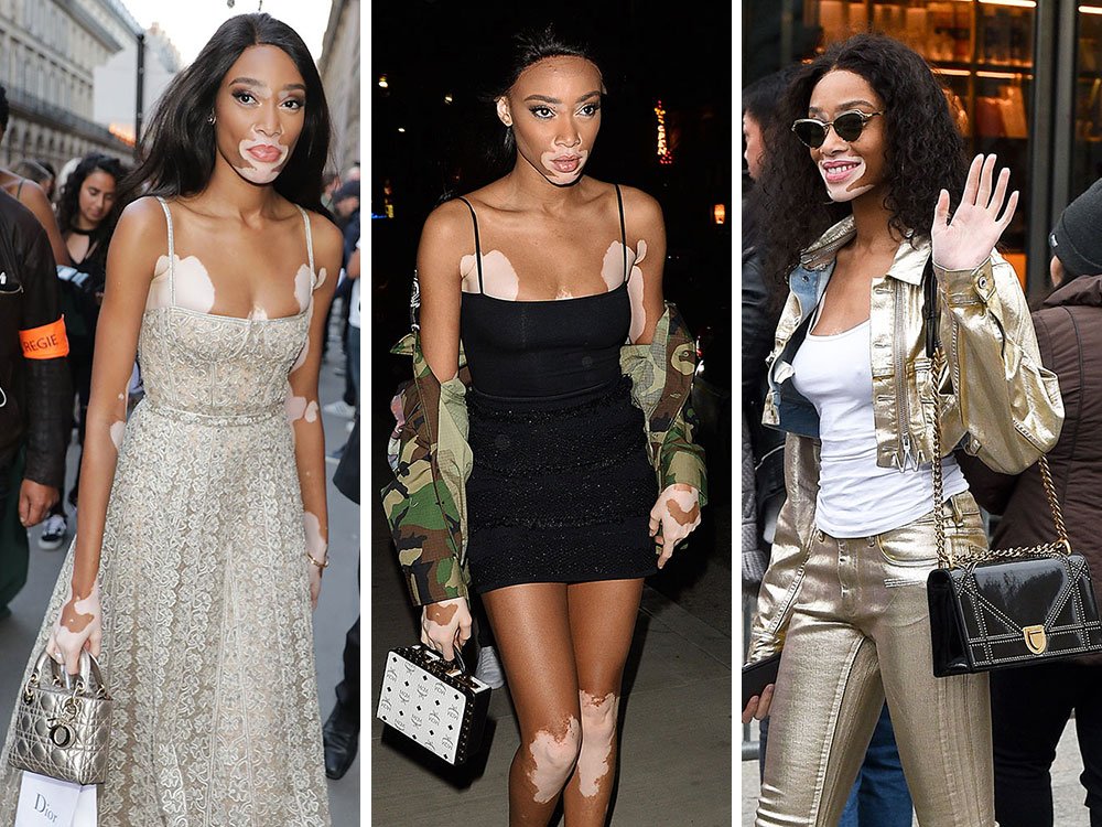 Reference image illustrating Winnie Harlow’s Fashion Week Bag Diary: Dior, MCM, and Moschino Looks from Milan to Paris